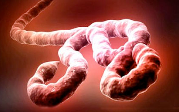 Ebola virüsü spermde iki yıl yaşayabiliyor