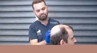 Saç Dökülmesi ve Saç Ekimi Hakkında Bilgilendirme