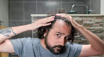 Saç dökülmesi durdurulabilir mi?